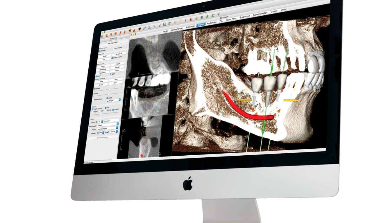 Anatomage Announces New 3D Dental Technology Subsidiary, Osteoid