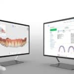 EasyRx Now Integrated with Medit Intraoral Scanner Line