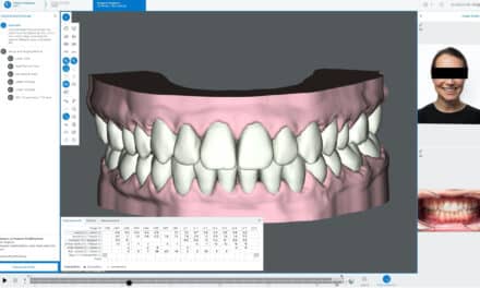 Dentsply Sirona Updates SureSmile Aligner Software