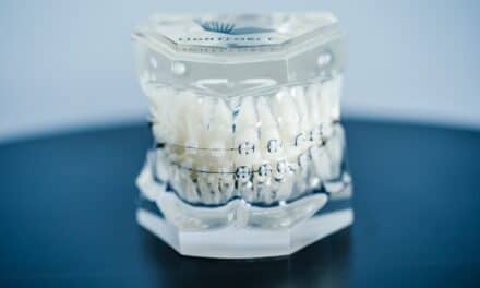 LightForce Orthodontics Raises $50 Million in Series C Funding Round