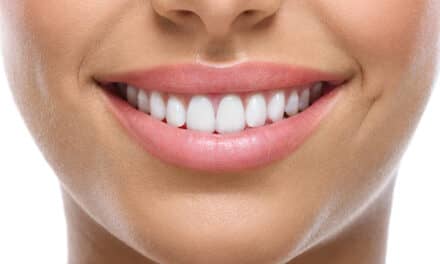 CAO Group Offers Teeth Whitening Strip System for In-Office and Take-Home Use