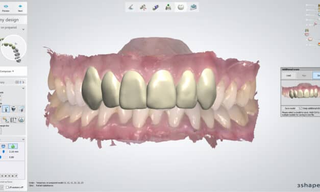 Dentsply Sirona Integrates Primescan and Omnicam Scanners with 3Shape Software