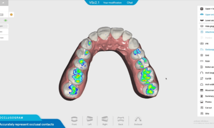 Align Technology Introduces Invisalign Moderate Package