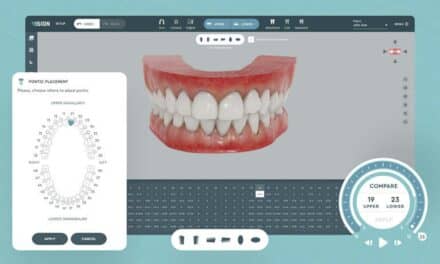 Partnership Brings SoftSmile Vision to Dental Axess Xflow Platform