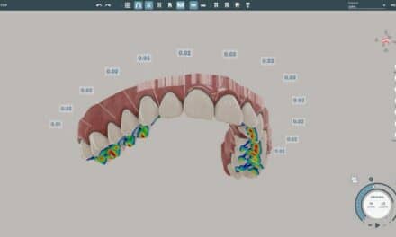 SoftSmile Vision Software Receives FDA Clearance