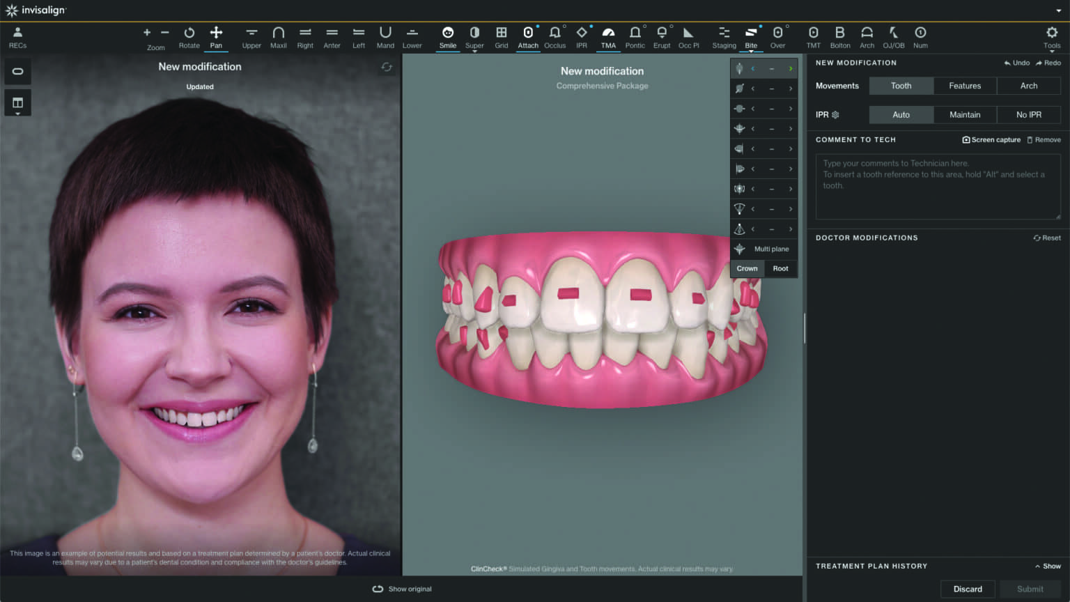 Focus on 2022 Orthodontic Treatment Planning Software Orthodontic