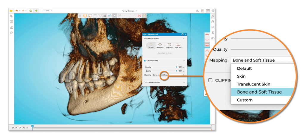 Ormco Spark Release 12 CBCT root visualization