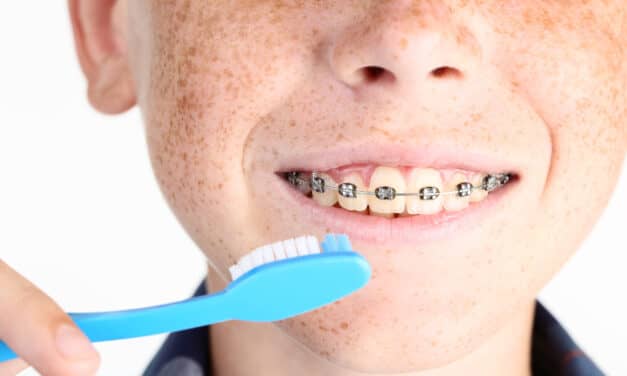 How to Encourage Kids to Maintain Good Oral Hygiene During Orthodontic Treatment