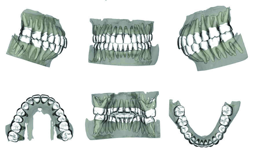 fig 3 virtual treatment planning using cbct