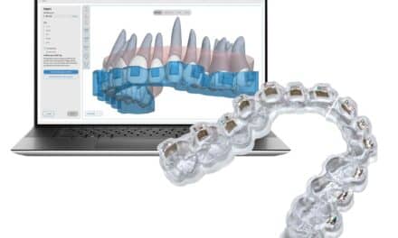 OrthoSelect Releases DIBS AI 7.0