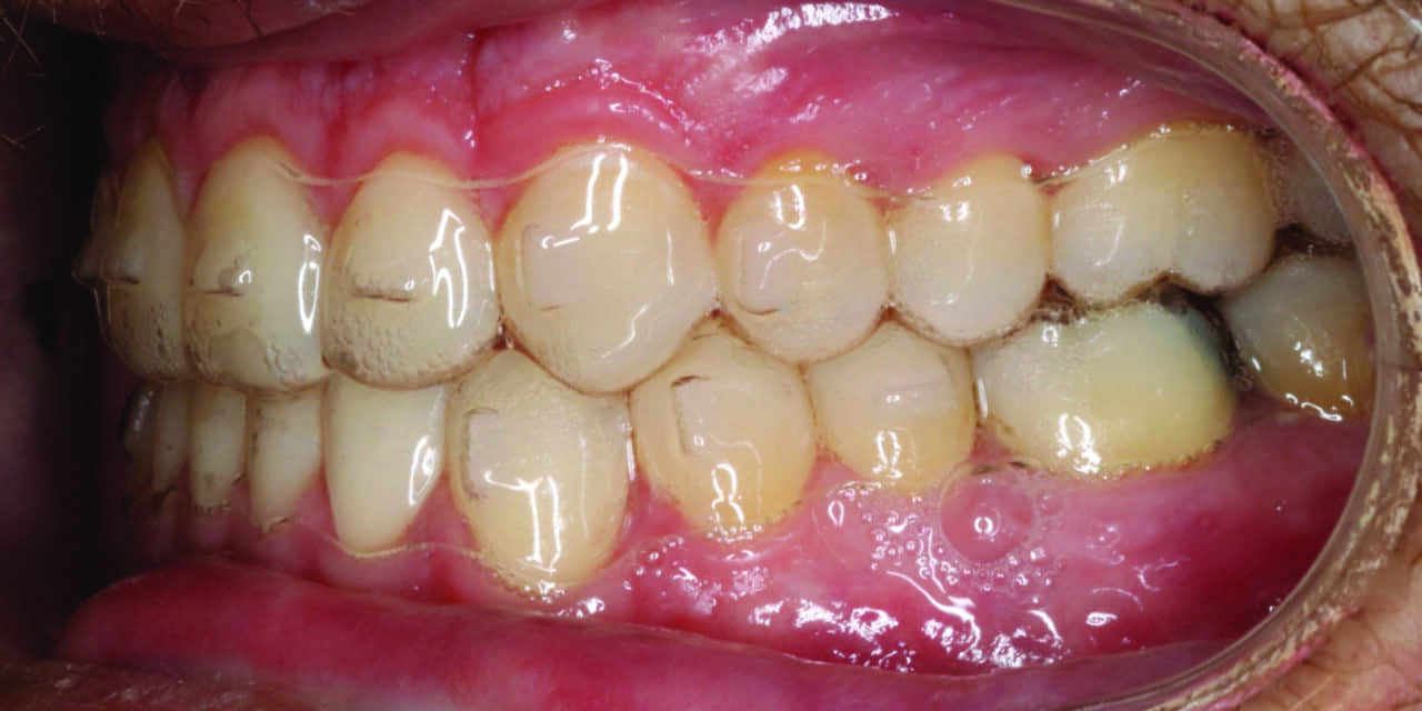 Remote Monitoring Yields Practice Growth Benefits Orthrodontic