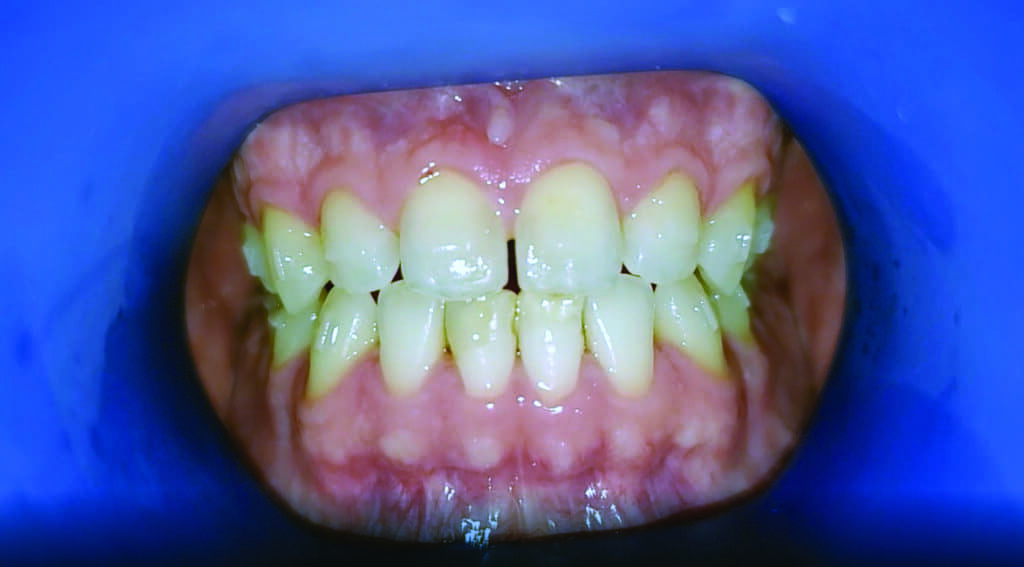 Patient Grin remote monitoring scan