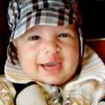Align Technology Grant Supports Infant Cleft Research