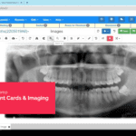 Check Out Treatment Card & Imaging Components Of Cloud 9’s Solution