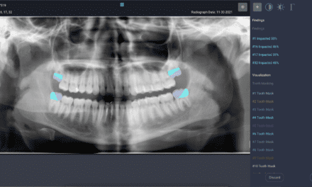 Carestream Dental Partners With Overjet for AI Technology