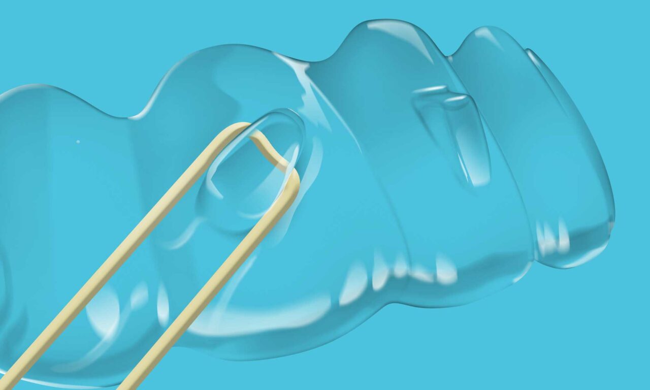 Ormco VP Breaks Down Spark Clear Aligner Release 13