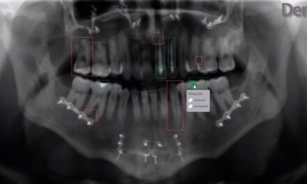 FDA Clears Denti.AI Auto-Chart Dental Software