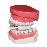 Gestenco Introduces Rodneys Aligner Seater with Rod