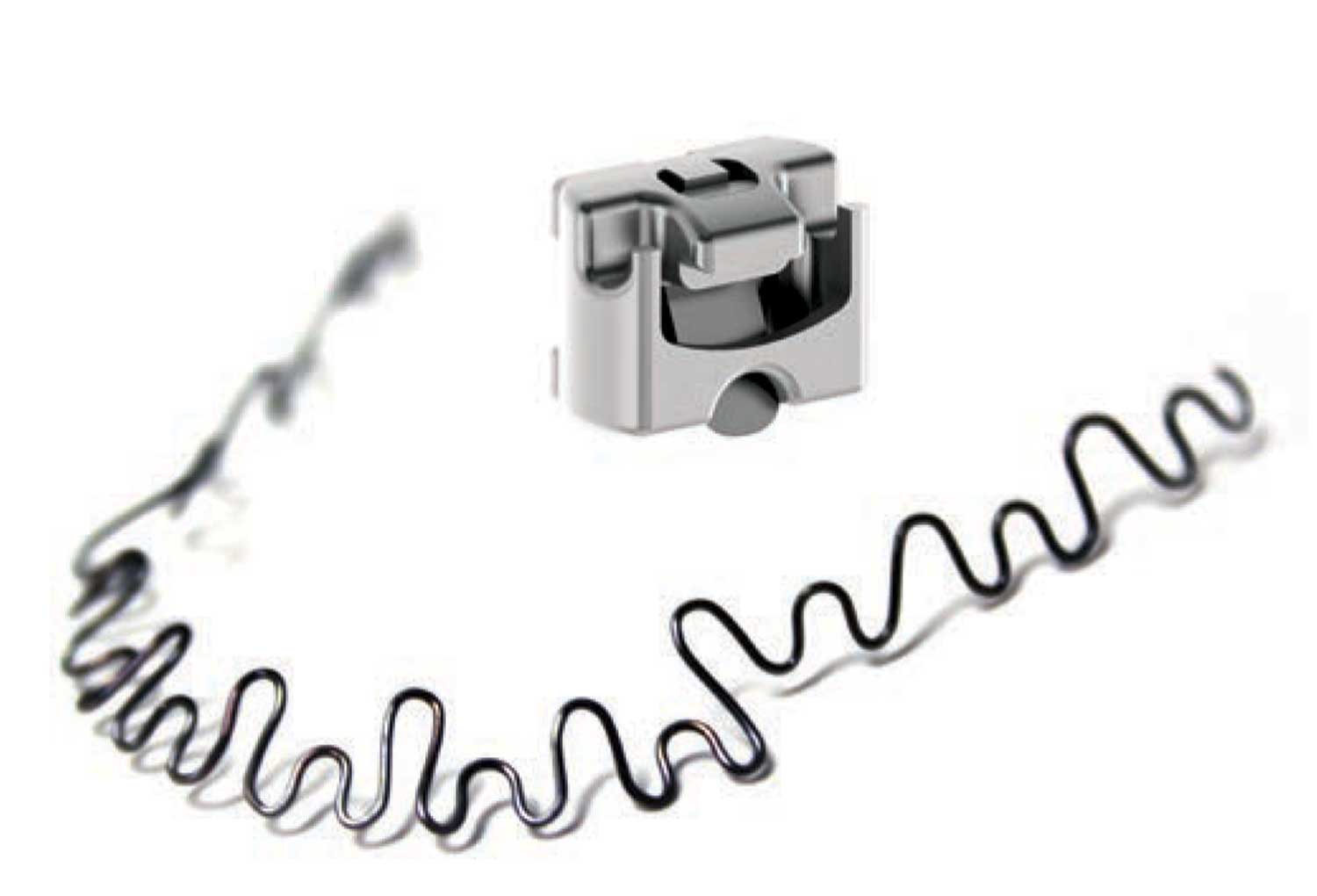 The InBrace System Orthodontic Treatment on Autopilot