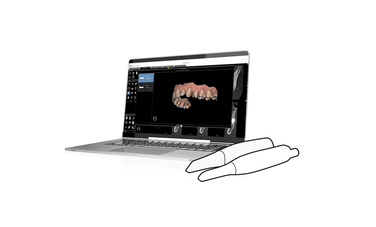 IO Scanner Link Improves Access With Intraoral Scans