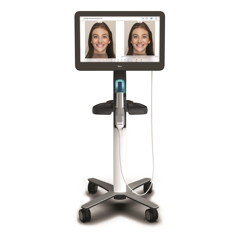 Align Technology Announces New iTero Lumina™ Intraoral Scanner Featuring a  3X Wider Field of Capture1 in a 50% Smaller Wand2 That Delivers Faster  Scanning, Higher Accuracy3, and Superior Visualization4 for Greater Practice