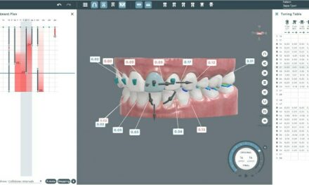 Partnership Brings Vision Treatment Planning to CandidPro