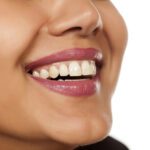 FDA Clears OrthoFX NiTime Aligners