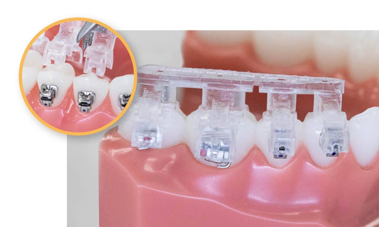 Bonding  Orthodontic Products