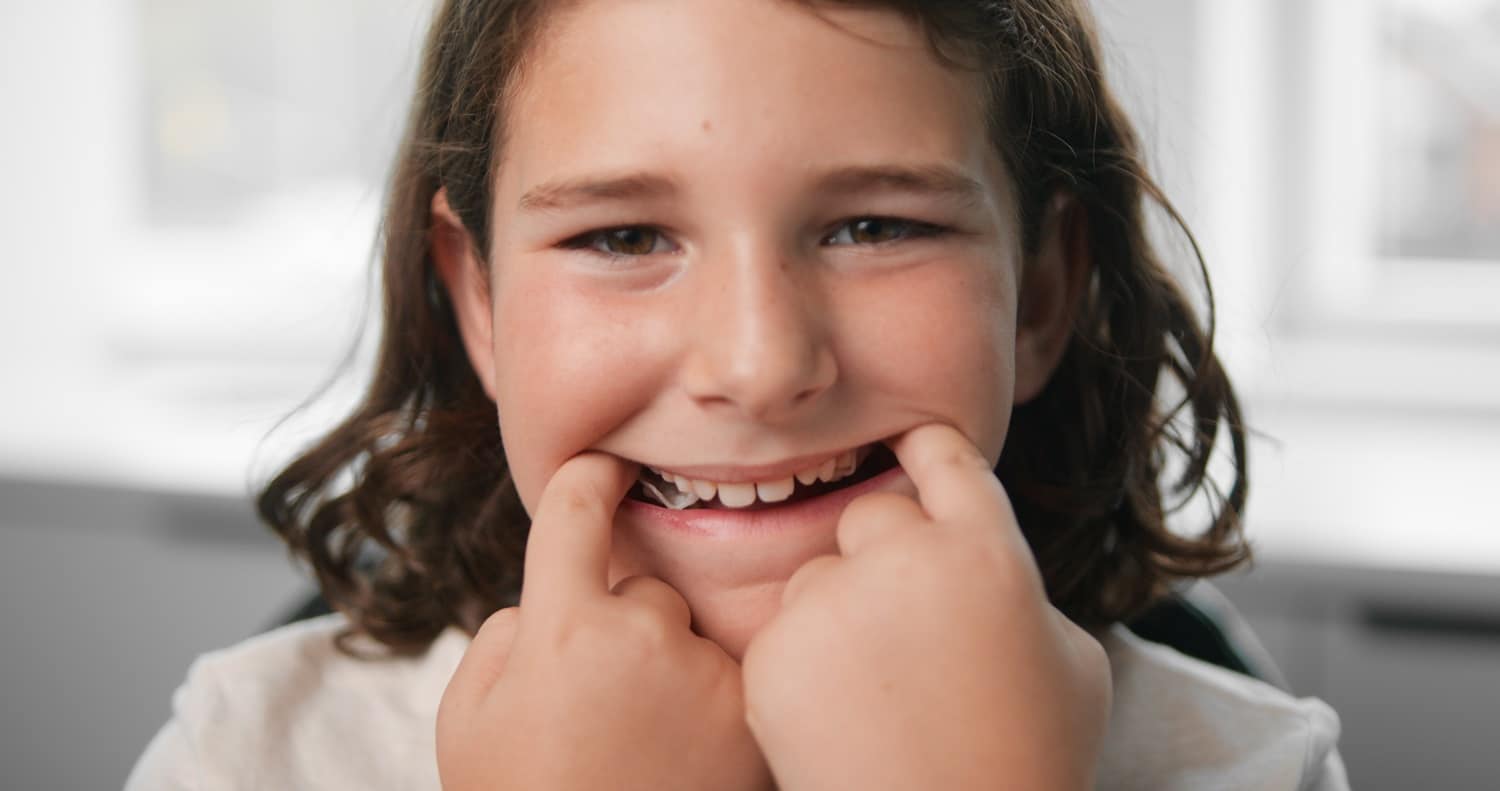 FDA Clears Invisalign Palatal Expander System Orthodontic Products