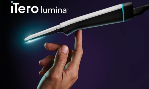 Align Launches iTero Lumina With a Wider Field of Capture