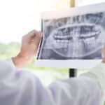 ADA No Longer Recommends Thyroid Collars