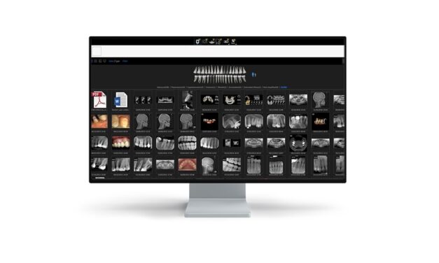 Carestream Click & Share Offers Second Opinions on 3D Images