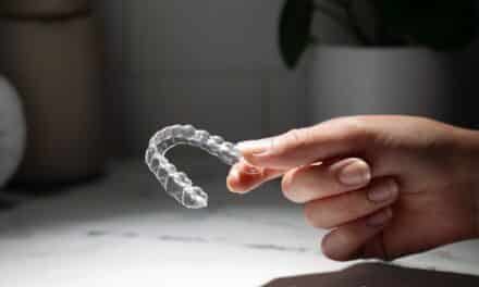 OrthoFX Designs NiTime Clear Aligners for Efficient Movement