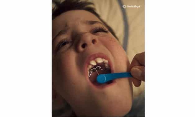 AAO Concerned Over Invisalign Palatal Expander System Ads