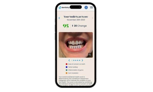 Dentistry.One Launches SmileScan for Remote Monitoring