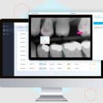 Pearl Launches Calibrate for X-Ray Evaluation Skill Enhancement