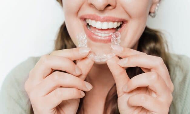 Clear Aligners