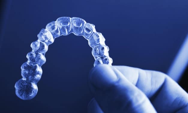 The Aligner Evolution: How Innovation is Reshaping Treatment 