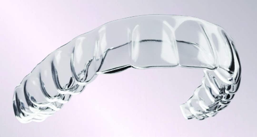 Industry Insider: A Closer Look at OrthoFX's Aligner Model