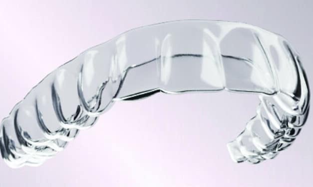 Industry Insider: A Closer Look at OrthoFX’s Aligner Model