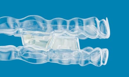 Align Launches Invisalign System with Occlusal Blocks for Class II Correction in Growing Patients