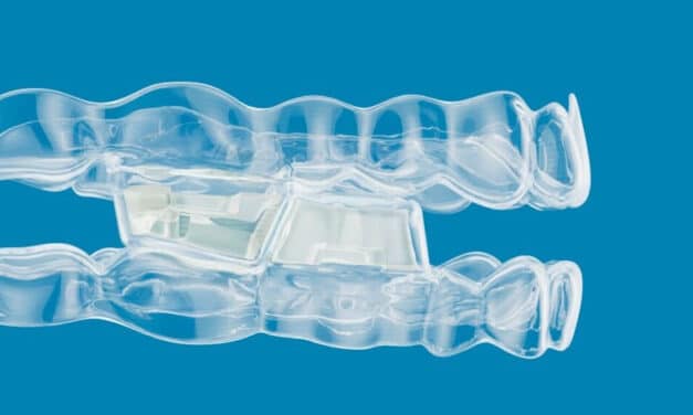 Align Launches Invisalign System with Occlusal Blocks for Class II Correction in Growing Patients