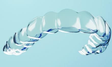 New Study Finds OrthoFX Aligners May Offer Greater Efficiency and Predictability
