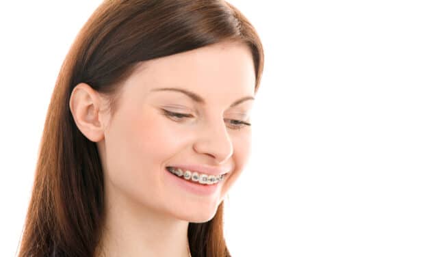 Custom by Design: How Digital Bracket and Wire Systems Are Reshaping Orthodontics