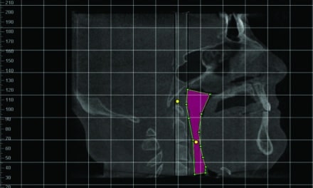Airway Friendly Orthodontics Part 3: Anterior-Posterior Solutions