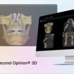 Pearl Becomes First Dental AI Company with FDA Clearance for Both 2D and 3D Imaging