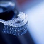 What’s New in Aligners in 2025