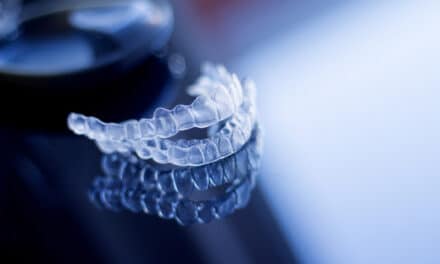 What’s New in Aligners in 2025