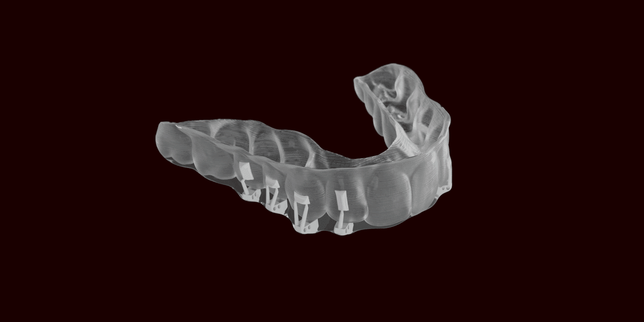 Industry Insider: After 3M Separation, Solventum Targets Digital Integration in Ortho