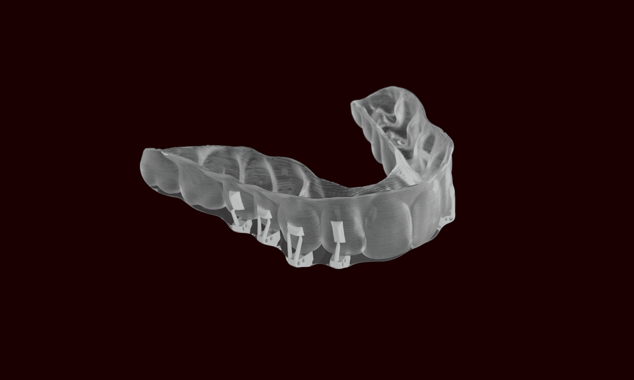Industry Insider: After 3M Separation, Solventum Targets Digital Integration in Ortho